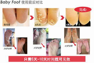 足部角质护理与健康/ Baby Foot