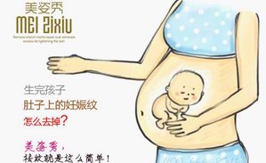 妊娠纹怎样能消除?10年妊娠纹真的能消掉吗