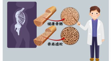 补肾抗衰系列谈——腰腿衰老并不是老年人的专利