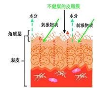 vinistyle教你掌控敏感肌，不做娇气“瓷娃娃”